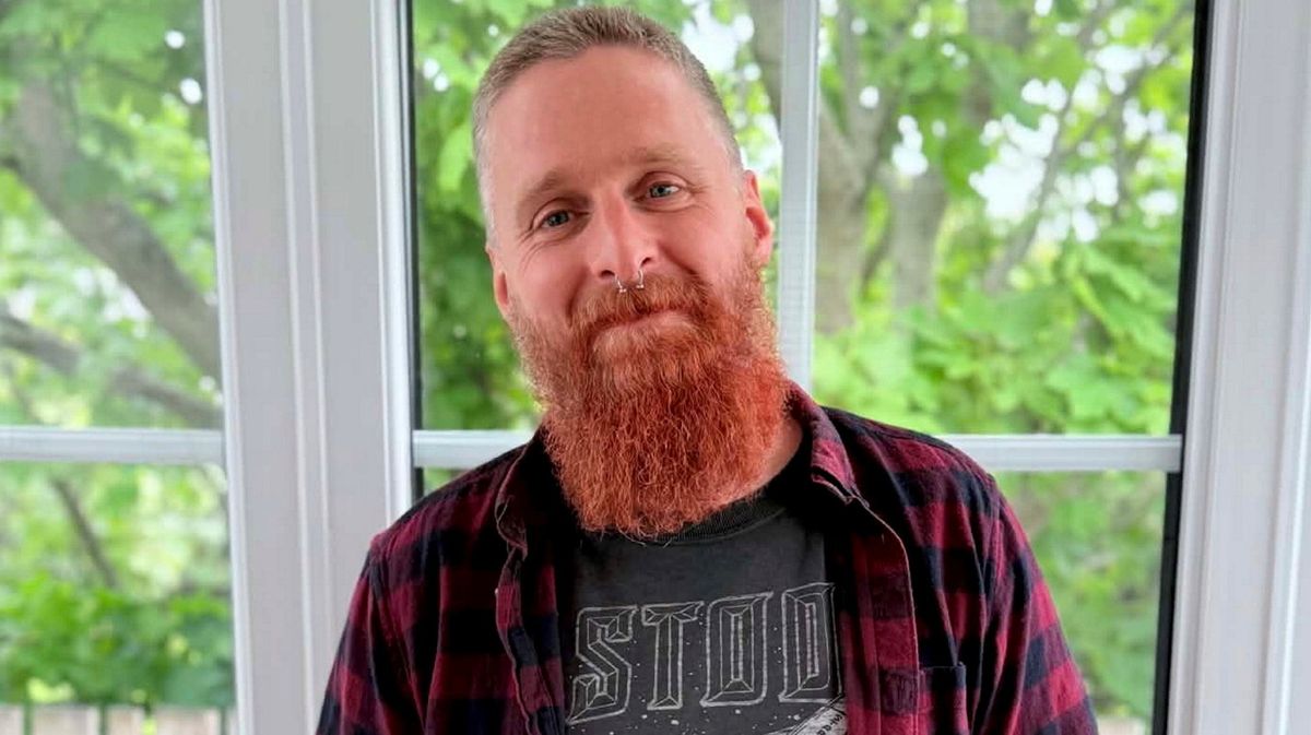 'Vape explosion in my pocket burned the skin off my leg - I'd to be airlifted to hospital': WARNING, GRAPHIC IMAGES: A hissing sound turned into a nightmare for Gavin Sutherland after a vape battery suddenly exploded in his pocket, leaving him needing a skin graft #VapeExplosion #VapingRisks #SafetyFirst #VapeSafety #InjuryAwareness 1 5539d384618ac014f48834d385273f78bb3dd582