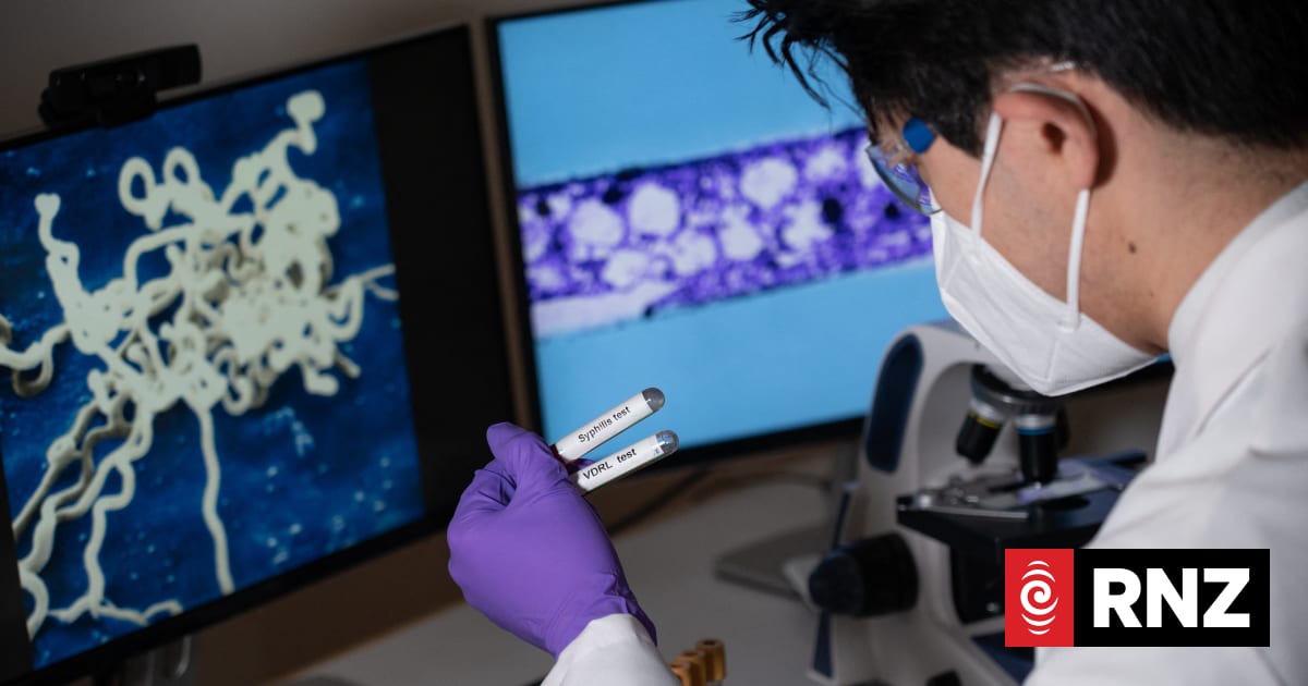 Fewer Kiwis contracting sexually transmitted diseases 1 2473c0e192aeb3e58bd254631eb16af6509ce41a0e59582e8768f771642c6c4f