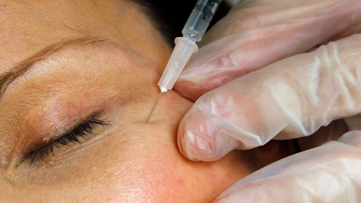 Six hospitalized after serious Botox poisonings in Zealand, authorities warn 1 28943482ef6dac9d3b355b5f02cb805d1c8f671c0804a09d8bff13714eb7d78c