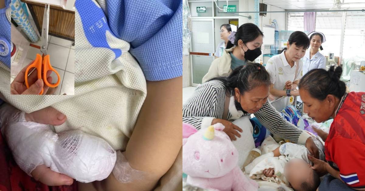Thai hospital apologises after nurse accidentally cuts off toddler's finger 1 ae759da956485ade47c91a07f6e654a31d7aa1aeab48b0f608254a5703fa8d8a