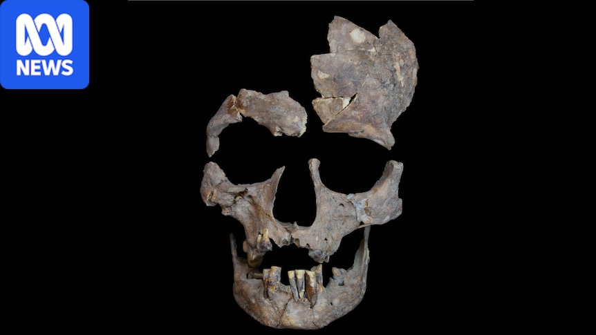 Betel nut traces in 25,000-year-old teeth point to early human drug use 1 bc9df7194cd067c4b8e484820f8a9fcc3773e4462f91d2e369d47239a2d81666